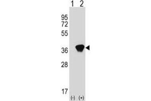 Western blot analysis of AKR1A1 antibody and 293 cell lysate (2 ug/lane) either nontransfected (Lane 1) or transiently transfected (2) with the AKR1A1 gene. (AKR1A1 Antikörper  (AA 293-325))