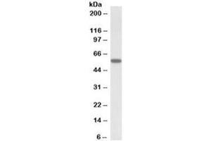 Western blot testing of human skeletal muscle lysate with DIXDC1 antibody at 0. (DIXDC1 Antikörper)