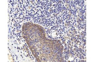 Immunohistochemistry analysis of paraffin-embedded human tonsil using PERK Polyclonal Antibody at dilution of 1:400. (PERK Antikörper)