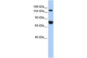 WB Suggested Anti-EEA1  Antibody Titration: 0. (EEA1 Antikörper  (Middle Region))
