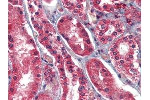 Human Kidney: Formalin-Fixed, Paraffin-Embedded (FFPE) (AIF Antikörper  (AA 593-606))