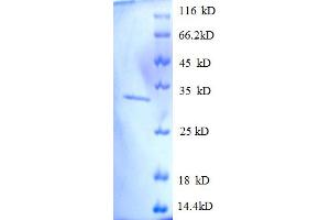 SDS-PAGE (SDS) image for Succinate Dehydrogenase Complex, Subunit A, Flavoprotein (Fp) (SDHA) (AA 44-293), (partial) protein (His tag) (ABIN5712197) (SDHA Protein (AA 44-293, partial) (His tag))