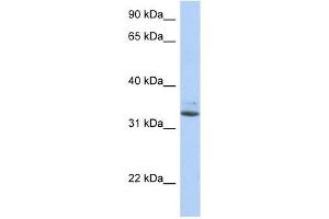 Western Blotting (WB) image for anti-Sulfotransferase Family, Cytosolic, 1A, Phenol-Preferring, Member 1 (SULT1A1) (N-Term) antibody (ABIN631191)