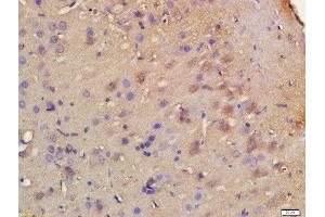 Formalin-fixed and paraffin embedded rat brain labeled with Rabbit Anti-HRH3/GPCR97 Polyclonal Antibody, Unconjugated 1:200 followed by conjugation to the secondary antibody and DAB staining