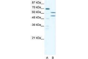 WB Suggested Anti-ZNF297B Antibody Titration: 5. (ZBTB43 Antikörper  (N-Term))