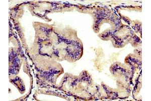 IHC image of ABIN7144136 diluted at 1:400 and staining in paraffin-embedded human prostate tissue performed on a Leica BondTM system. (AGT Antikörper  (AA 44-427))