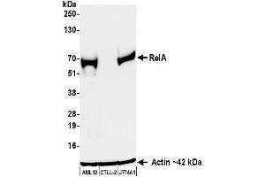 Western Blotting (WB) image for anti-Nuclear Factor-kB p65 (NFkBP65) (C-Term) antibody (ABIN7795799)