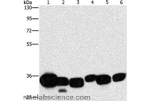 Western blot analysis of Mouse liver and human fetal lung tissue, hela cell and mouse kidney tissue, human brain malignant glioma tissue and K562 cell, using CBR1 Polyclonal Antibody at dilution of 1:1000 (CBR1 Antikörper)