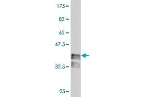 Western Blot detection against Immunogen (37 KDa) . (LHX4 Antikörper  (AA 291-390))