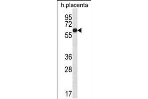 Western blot analysis in human placenta tissue lysates (35ug/lane). (GLCCI1 Antikörper  (AA 226-255))