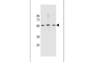 KCNK18 Antibody (Center) (ABIN657542 and ABIN2846557) western blot analysis in SiHa,,MCF-7 cell line lysates (35 μg/lane). (KCNK18 Antikörper  (AA 168-197))