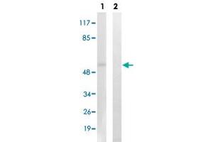 Western blot analysis of Lane 1: Untreated K562 cell lysates, Lane 2: Synthesized peptide treated K562 cell lysates reacted with AKT1/AKT3 (phospho Y437/Y434) polyclonal antibody  at 1:500-1:3000 dilution. (AKT1/3 (pTyr437), (Tyr434) Antikörper)