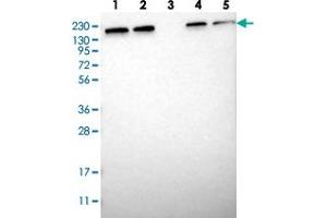 Western blot analysis of Lane 1: RT-4, Lane 2: U-251 MG, Lane 3: Human Plasma, Lane 4: Liver, Lane 5: Tonsil with UGCGL1 polyclonal antibody . (UGGT1 Antikörper)