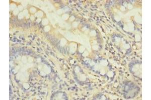 Immunohistochemistry of paraffin-embedded human small intestine tissue using ABIN7163345 at dilution of 1:100 (DDHD2 Antikörper  (AA 361-650))
