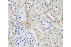 Immunohistochemistry of paraffin-embedded Rat kidney using UBE3A Polyclonal Antibody at dilution of 1:200 (40x lens). (ube3a Antikörper)