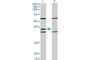 Western Blot analysis of PAX9 expression in transfected 293T cell line by PAX9 monoclonal antibody (M03), clone 4B9.