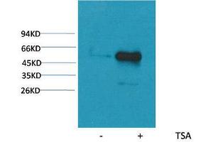 Western Blot (WB) analysis of extracts from HeLa cells, untreated (-) or treated with TSA (1muM, 18 hr+), using Acetyl- a-tubulin(Lys40) Mouse Monoclonal Antibody 1:2000. (alpha Tubulin Antikörper  (acLys40))