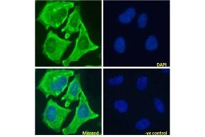 Immunofluoresence staining of fixed HeLa cells with anti-Notch 1 antibody E6. (Rekombinanter Notch1 Antikörper)