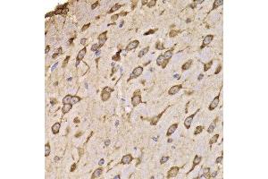 Immunohistochemistry of paraffin-embedded mouse brain using RPS14 antibody at dilution of 1:100 (x400 lens). (RPS14 Antikörper)