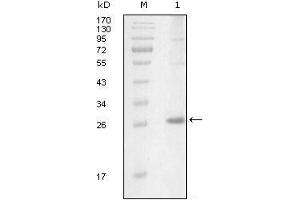 Western blot analysis using ITK mouse mAb against truncated Trx-ITK recombinant protein (1). (ITK Antikörper  (AA 2-110))