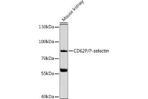 Western blot analysis of extracts of mouse kidney, using CD62P/P-selectin Antibody (ABIN6131512, ABIN6147501, ABIN6147504 and ABIN6216152) at 1:1000 dilution. (P-Selectin Antikörper  (AA 220-319))