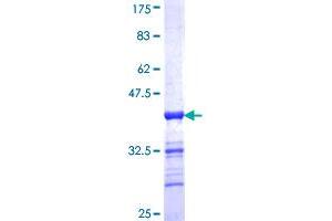 Image no. 1 for Ecotropic Viral Integration Site 2B (EVI2B) (AA 23-121) protein (GST tag) (ABIN1353198) (EVI2B Protein (AA 23-121) (GST tag))