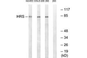Western blot analysis of extracts from 293/COLO/HuvEc cells, using HRS (Ab-334) Antibody. (HRS (HRS) (AA 301-350) Antikörper)