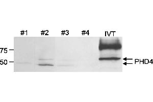 Western Blotting (WB) image for anti-Prolyl 4-Hydroxylase, Transmembrane (Endoplasmic Reticulum) (P4HTM) (C-Term) antibody (ABIN7449275)