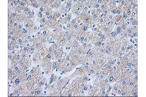 Immunohistochemical staining of paraffin-embedded Human liver tissue using anti-TTC32 mouse monoclonal antibody. (TTC32 Antikörper)