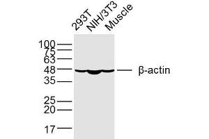 Lane 1: 293T, Lane 2: NIH/3T3, Lane 3: mouse muscle lysates probed with beta-Actin (1A2) Monoclonal Antibody (bsm-33036M) at 1:300 overnight at 4°C followed by a conjugated secondary antibody for 60 minutes at 37°C.