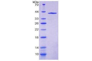SDS-PAGE (SDS) image for Myosin VA (MYO5A) (AA 1531-1855) protein (His tag) (ABIN1981139)