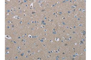 The image on the left is immunohistochemistry of paraffin-embedded Human brain tissue using ABIN7191864(PHKA2 Antibody) at dilution 1/30, on the right is treated with synthetic peptide. (PHKA2 Antikörper)