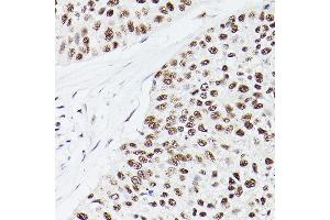 Immunohistochemistry (IHC) image for anti-E1A Binding Protein P300 (EP300) (AA 1-270) antibody (ABIN6140193)