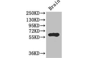 Western Blot Positive WB detected in: Mouse brain tissue All lanes: ICE1 antibody at 2. (ICE1 (AA 1213-1505) Antikörper)