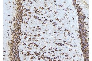 ABIN6275540 at 1/100 staining Mouse brain tissue by IHC-P. (TAO Kinase 1 (TAOK1) (Internal Region) Antikörper)