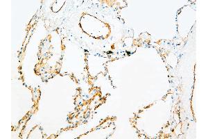 Immunohistochemistry (IHC) image for anti-Platelet/endothelial Cell Adhesion Molecule (PECAM1) antibody (ABIN108424)