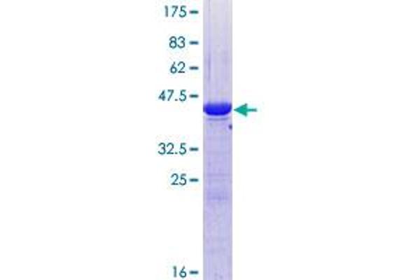 UBE2G1 Protein (AA 1-170) (GST tag)