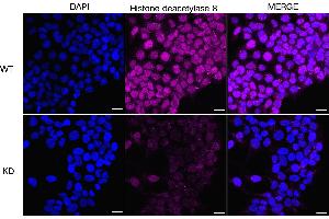 anti-Histone Deacetylase 8 (HDAC8) antibody