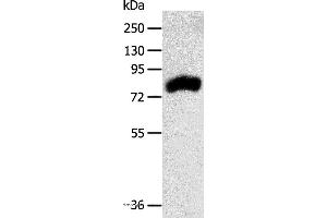 Western blot analysis of Mouse kidney tissue, using RPAP3 Polyclonal Antibody at dilution of 1:400 (RPAP3 Antikörper)