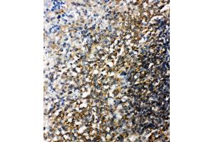 Anti-Bid antibody, IHC(P) IHC(P): Rat Spleen Tissue (BID Antikörper  (C-Term))