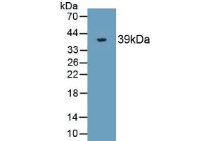 Detection of Recombinant ST2, Human using Monoclonal Antibody to Syntenin 2 (ST2) (SDCBP2 Antikörper  (AA 1-292))