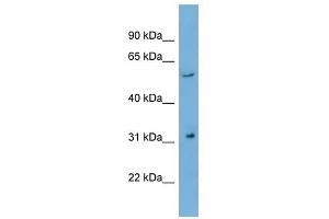 REM1 antibody used at 1 ug/ml to detect target protein. (REM1 Antikörper)