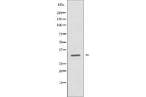 Western blot analysis of extracts from HUVEC cells, using MRPL24 antibody. (MRPL24 Antikörper  (Internal Region))