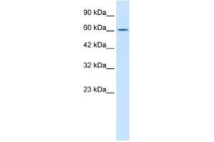 WB Suggested Anti-TRIM17 Antibody Titration:  0. (TRIM17 / RNF16 Antikörper  (Middle Region))
