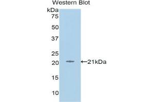 Detection of Recombinant L1CAM, Human using Polyclonal Antibody to L1-Cell Adhesion Molecule (L1CAM) (L1CAM Antikörper  (AA 526-690))