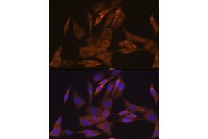 Immunofluorescence analysis of NIH-3T3 cells using KIF Rabbit mAb (ABIN7268120) at dilution of 1:100 (40x lens). (KIFAP3 Antikörper)