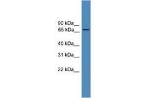 Image no. 1 for anti-Zinc Finger Protein 304 (ZNF304) (N-Term) antibody (ABIN6745262) (ZNF304 Antikörper  (N-Term))