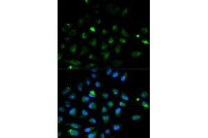 Immunofluorescence analysis of HeLa cells using PRF1 antibody (ABIN5970001). (Perforin 1 Antikörper)