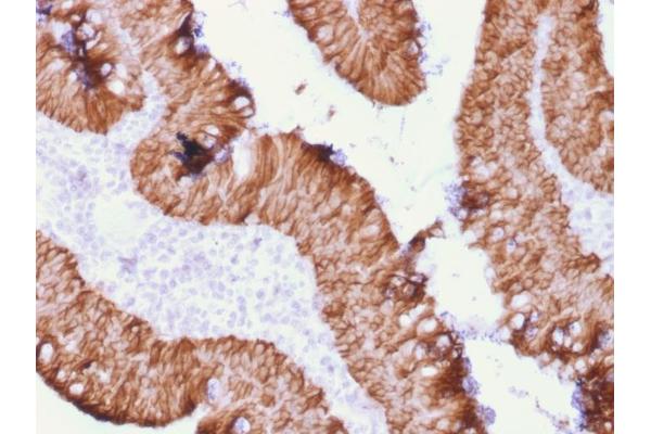 Rekombinanter EpCAM Antikörper  (Extracellular Domain)
