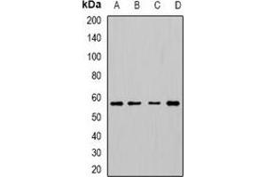Western blot analysis of Cytochrome P450 3A5 expression in HepG2 (A), SW480 (B), mouse lung (C), mouse thumus (D) whole cell lysates. (CYP3A5 Antikörper)